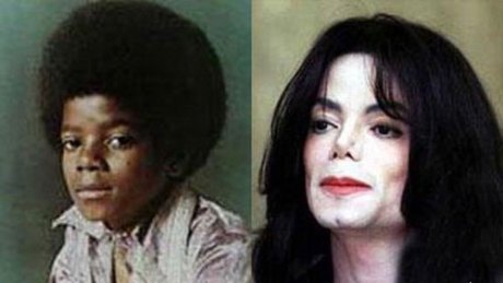 Brusca mudança física de Michael. Compare as fotos dele aos cinco anos e a outra, mais recente.